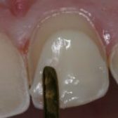 4 روش جلوگیری از زرد شدن دندان ها