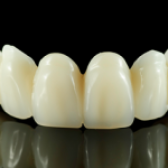 5 روش مؤثر تشخیص نیاز به لمینت یا کامپوزیت دندان