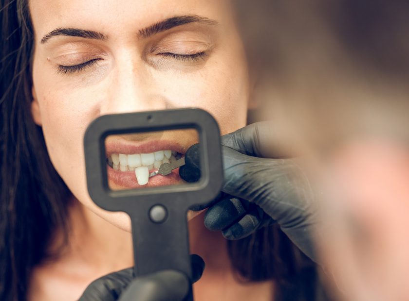 Dentist checking veneer implant for woman with dental instruments