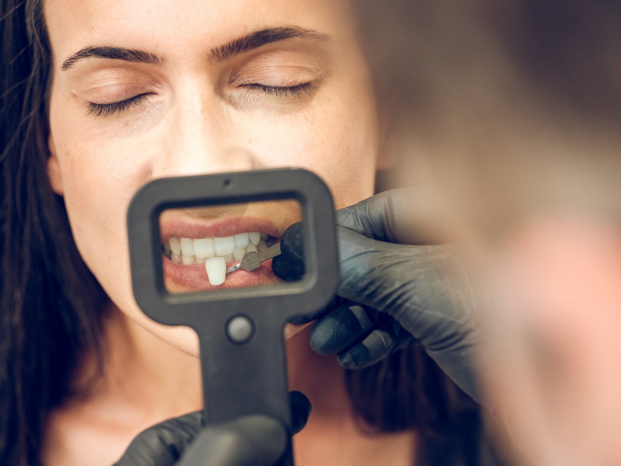 Dentist checking veneer implant for woman with dental instruments