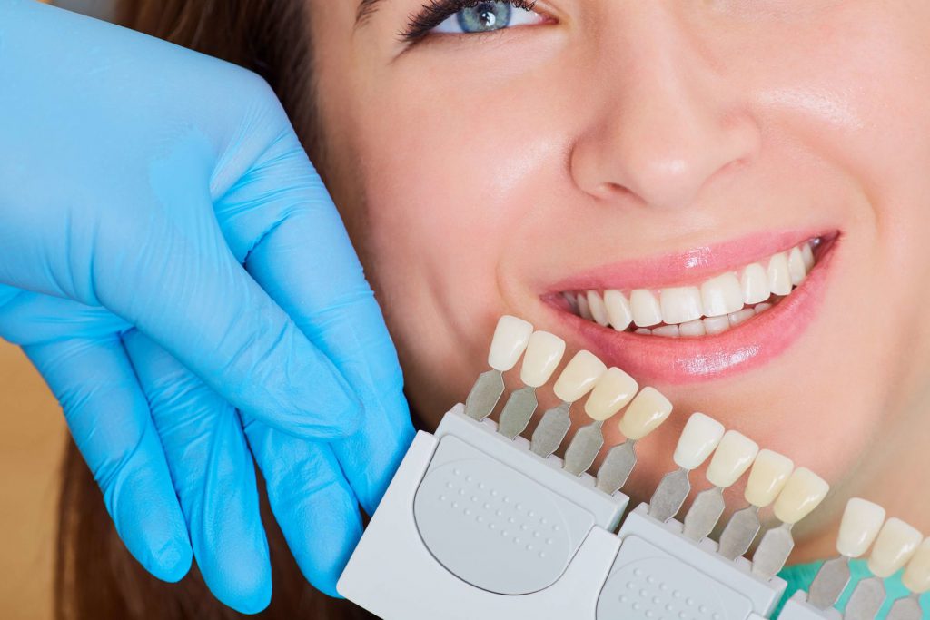 متخصص دندانپزشک زیبایی برای انتخاب بهترین رنگ کامپوزیت دندان، نمونهای مختلفی را امتحان می‌کند.