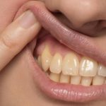 9 علت زرد شدن دندان +  4 روش‌ خانگی رفع زردی دندان