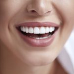کامپوزیت دندان چیست؟ رقابت بین لمینت و کامپوزیت