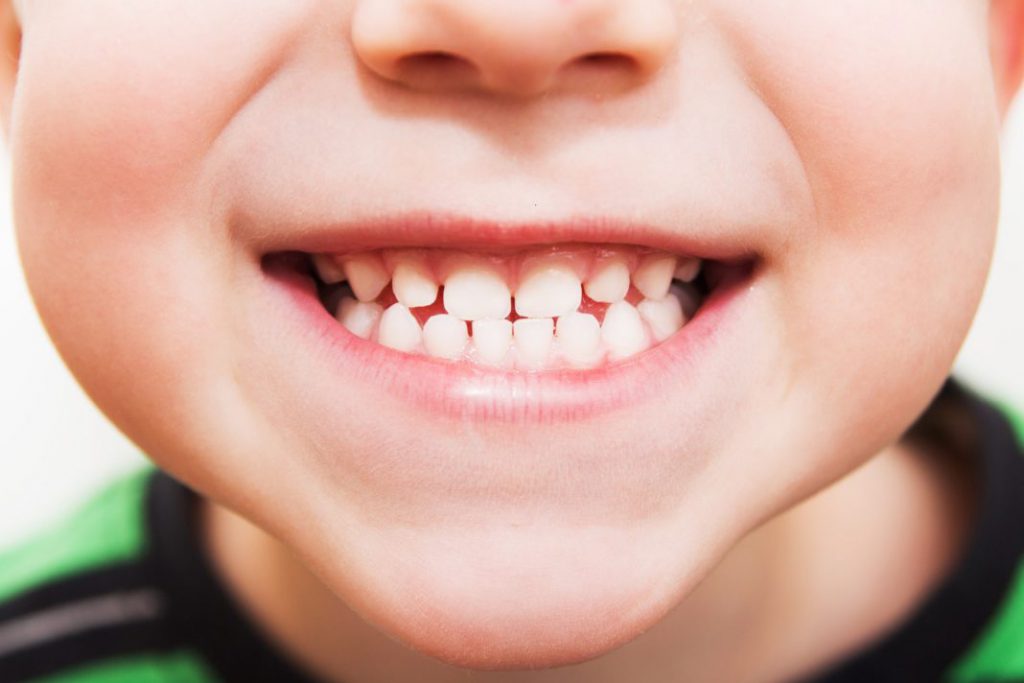 سن مناسب برای کامپوزیت دندان برای سنین مختلف توسط دندانپزشک متخصص صورت میگیرد.