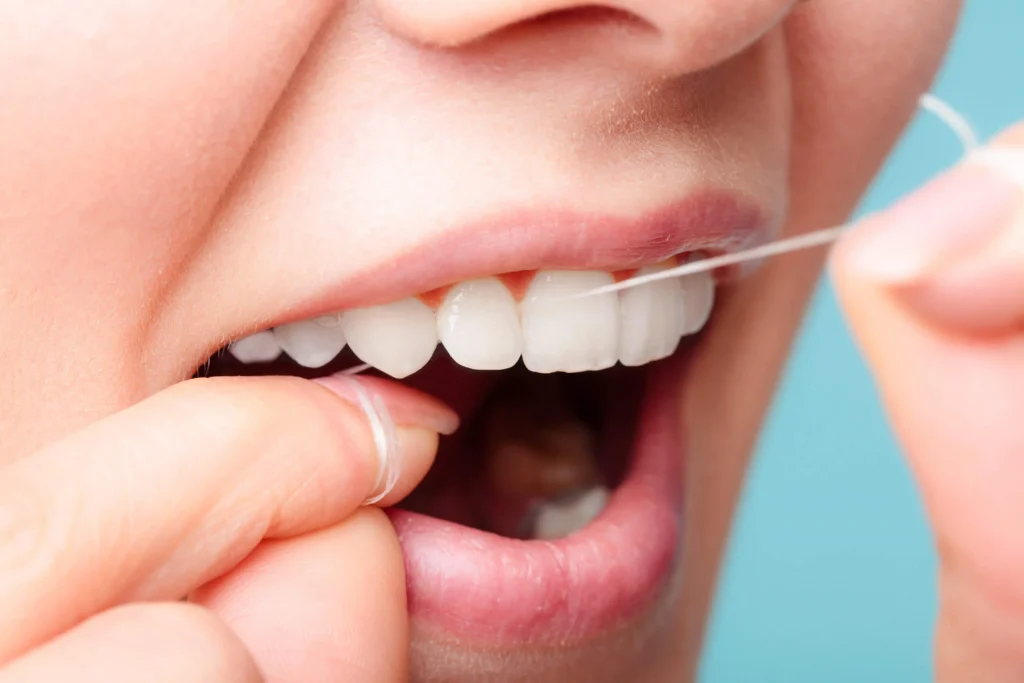 نخ دندان، تاثیر بیشتری نسبت به مسواک زدن در نگهداری از لمینت دارد.